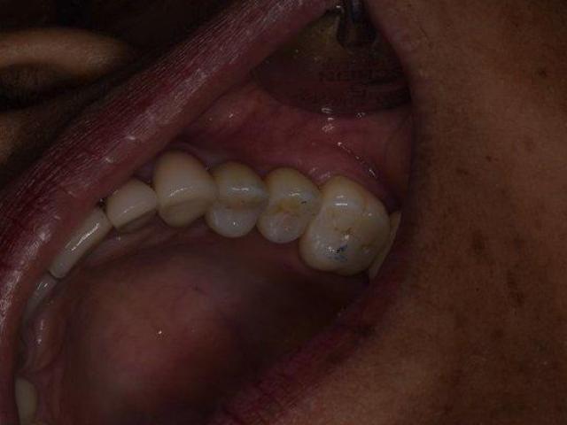 Trusted Dental Clinic in Tijuana – Comprehensive Care for a Brighter, Healthier Smile