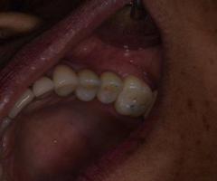 Trusted Dental Clinic in Tijuana – Comprehensive Care for a Brighter, Healthier Smile