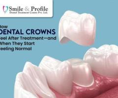 Missing or Damaged Teeth Affecting Your Smile?