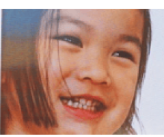 Professional Autism Therapy in Pilsen Chicago