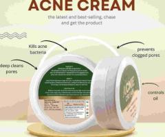 Natural Acne Cream for Acne-Prone Skin