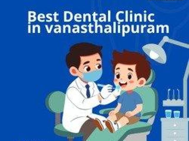 Advanced Dental Implants Treatment — Vanasthalipuram Clinic