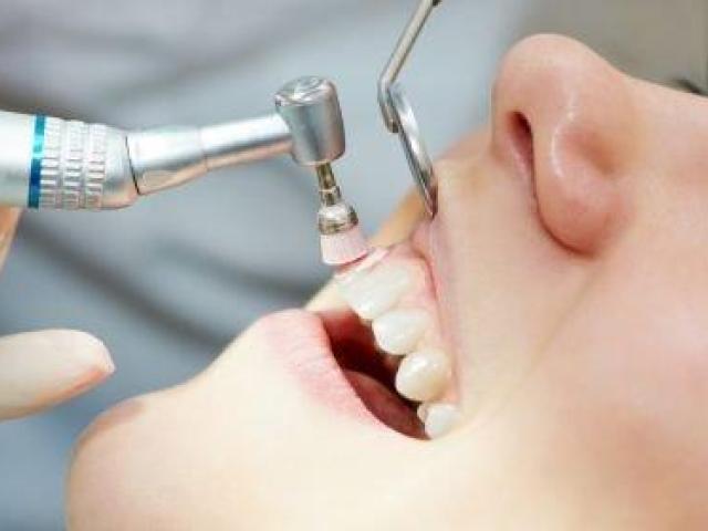 Professional Teeth Whitening in Foster City, CA