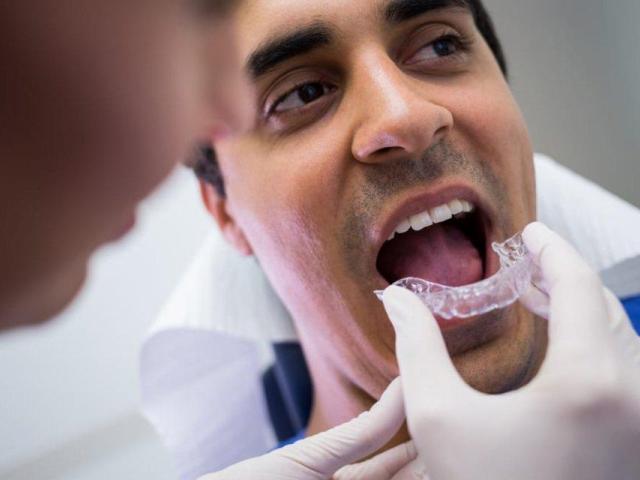 DENTAL IMPLANTS IN MADURAI