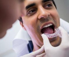 DENTAL IMPLANTS IN MADURAI