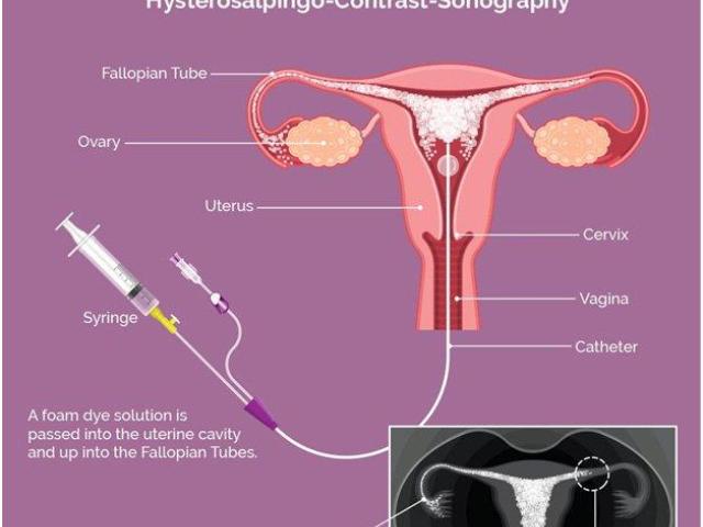 IVF and Genetic Testing in Abu Dhabi
