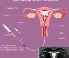 IVF and Genetic Testing in Abu Dhabi