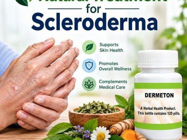 Natural Support for Scleroderma Skin Symptoms
