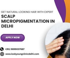 Get Natural Looking Hair with Expert Scalp Micropigmentation in Delhi