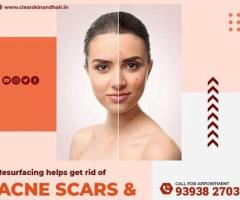 Laser treatment clinic in india