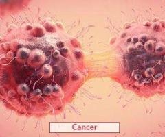 Affordable & Advanced Cancer Treatment in India | Edhacare