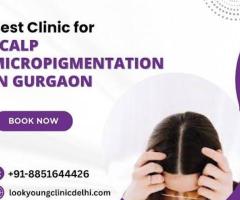Best Clinic for Scalp Micropigmentation in Gurgaon