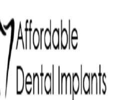 Queens Affordable Dental Implants