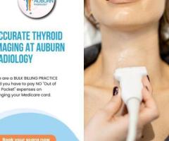 Accurate Thyroid Imaging at Auburn Radiology. (02) 8315 8292